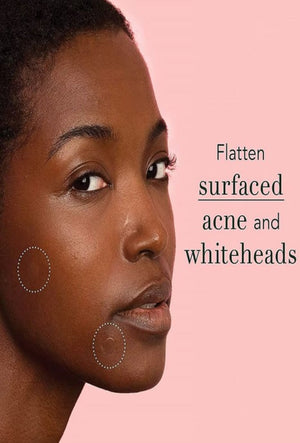 THE ORIGINAL HYDROCOLLOID ACNE PIMPLE PATCH