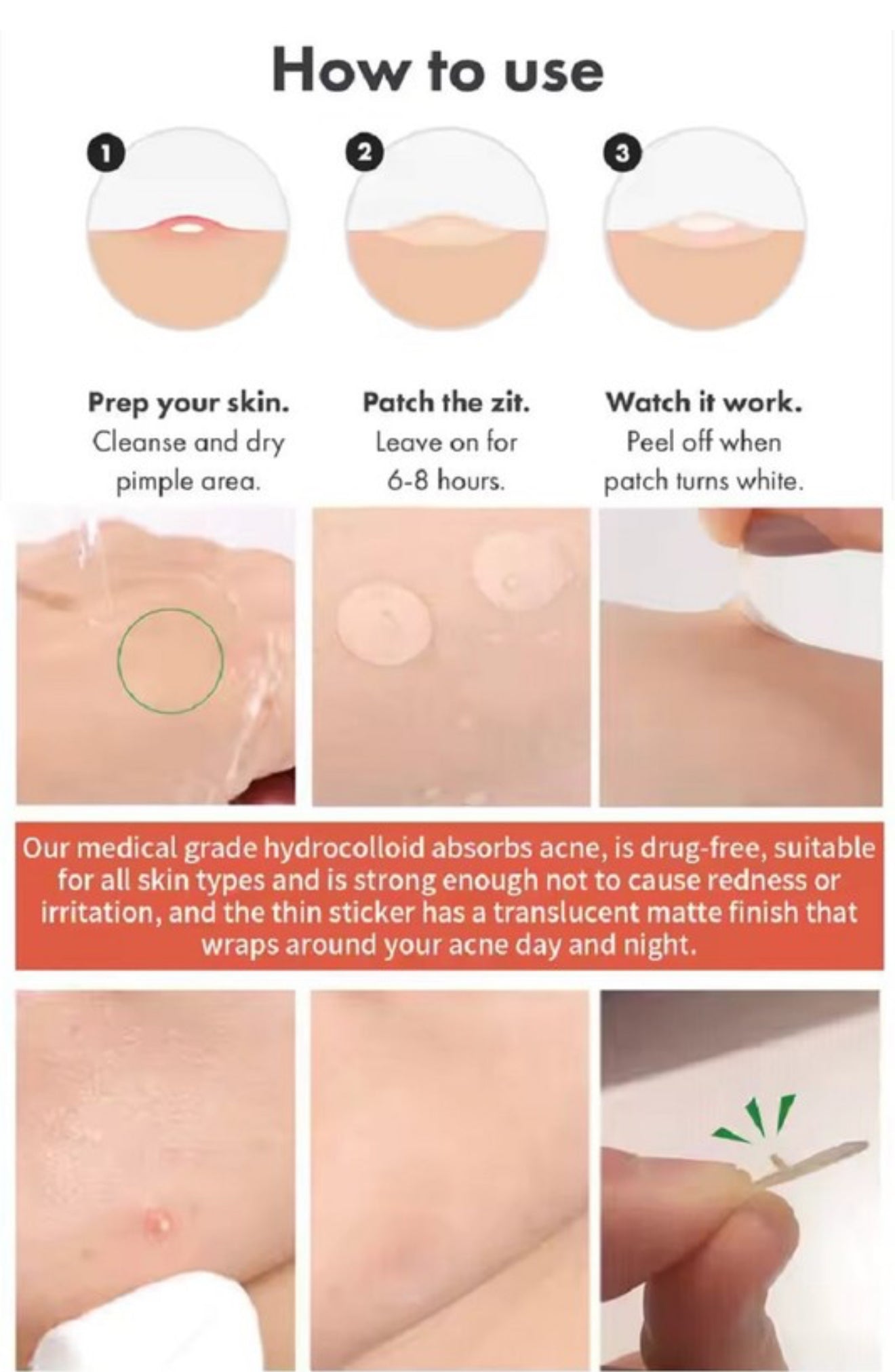 THE ORIGINAL HYDROCOLLOID ACNE PIMPLE PATCH