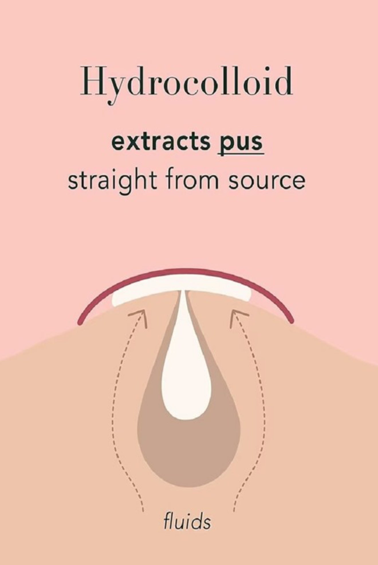 THE ORIGINAL HYDROCOLLOID ACNE PIMPLE PATCH