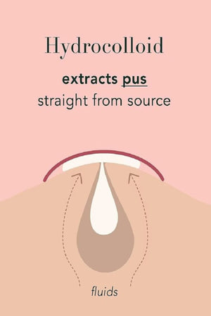 THE ORIGINAL HYDROCOLLOID ACNE PIMPLE PATCH